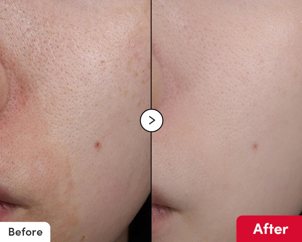 Vitamin illuminating Serum